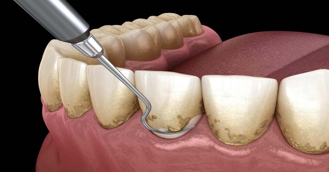 Dental Clinic in Paldi